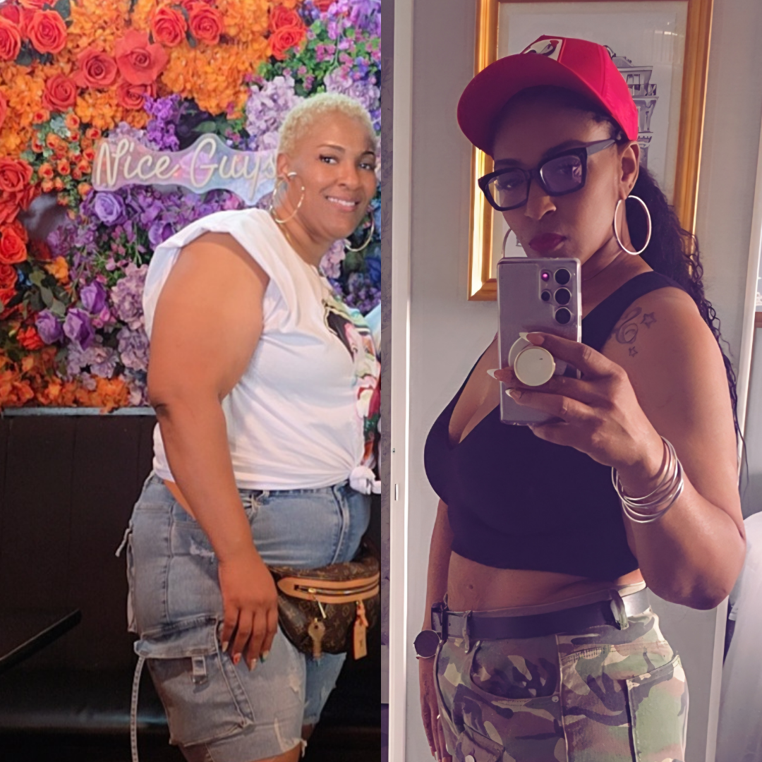 Terren before and after losing weight at Everglow Miami