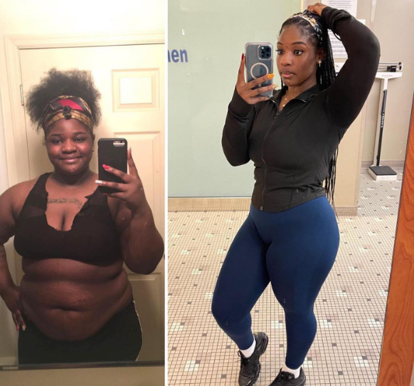 Marie before and after losing weight at Everglow Miami
