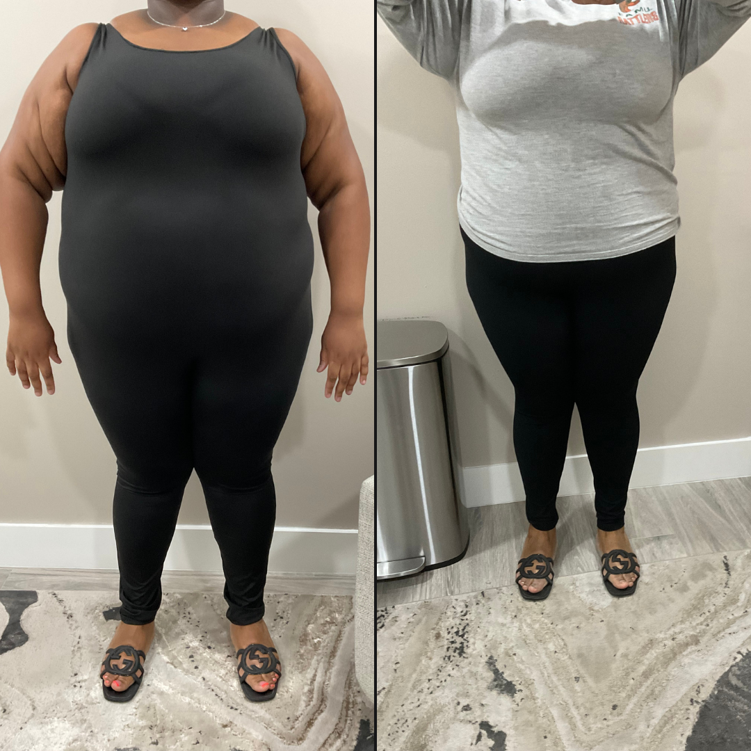 Monica - Before and After Transformation